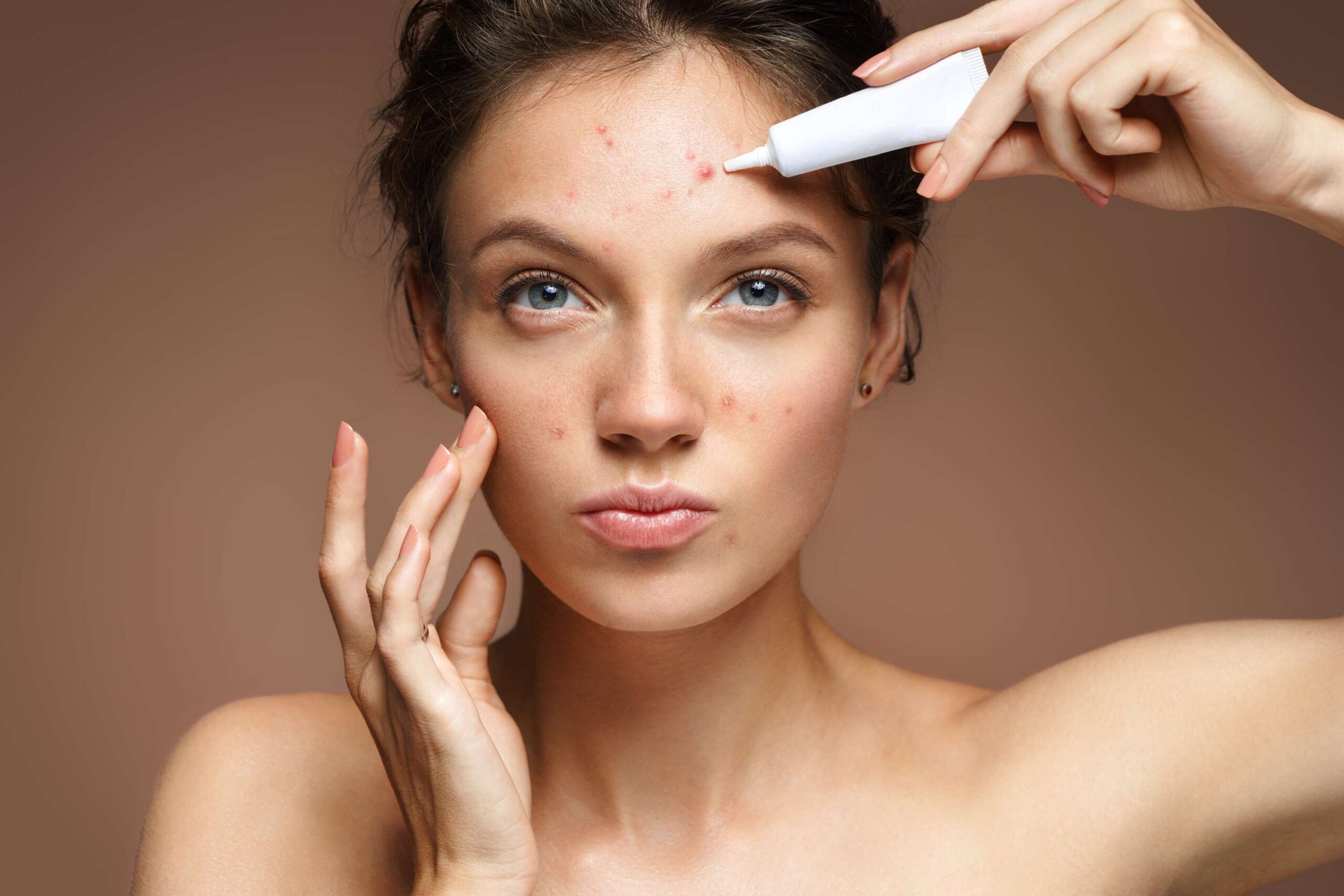 A women putting Cream on her face | New Look Skin Center Medical Spa in Glendale, Encino and Irvine, CA
