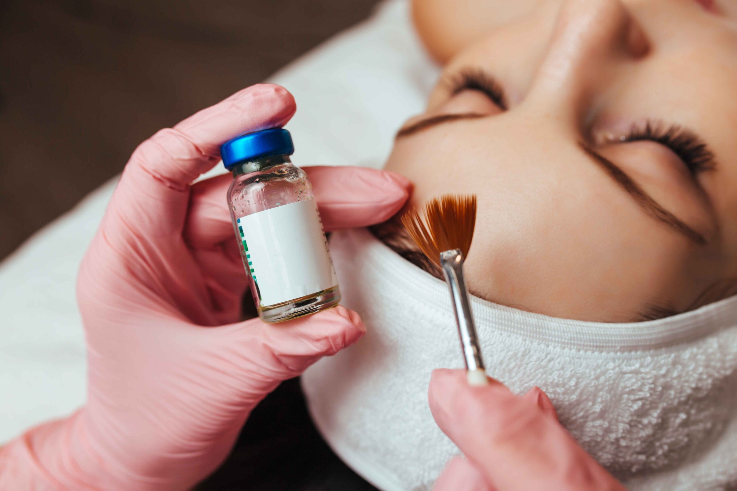 Chemical Peels | New Look Skin Center Medical Spa in Glendale, Encino and Irvine, CA