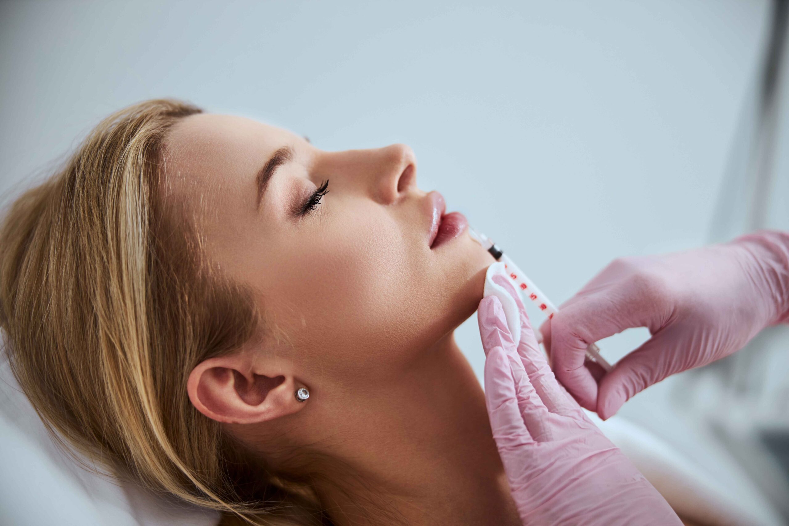 Lip Filler Benefits | New Look Skin Center Medical Spa in Glendale, Encino and Irvine, CA