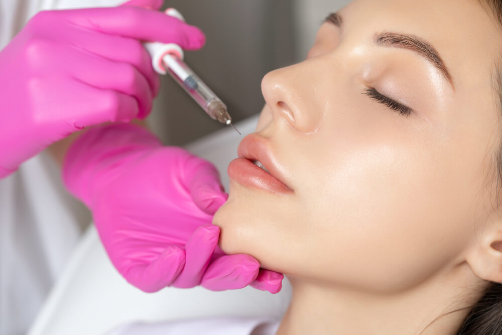Lip Filler | New Look Skin Center Medical Spa in Glendale, Encino and Irvine, CA