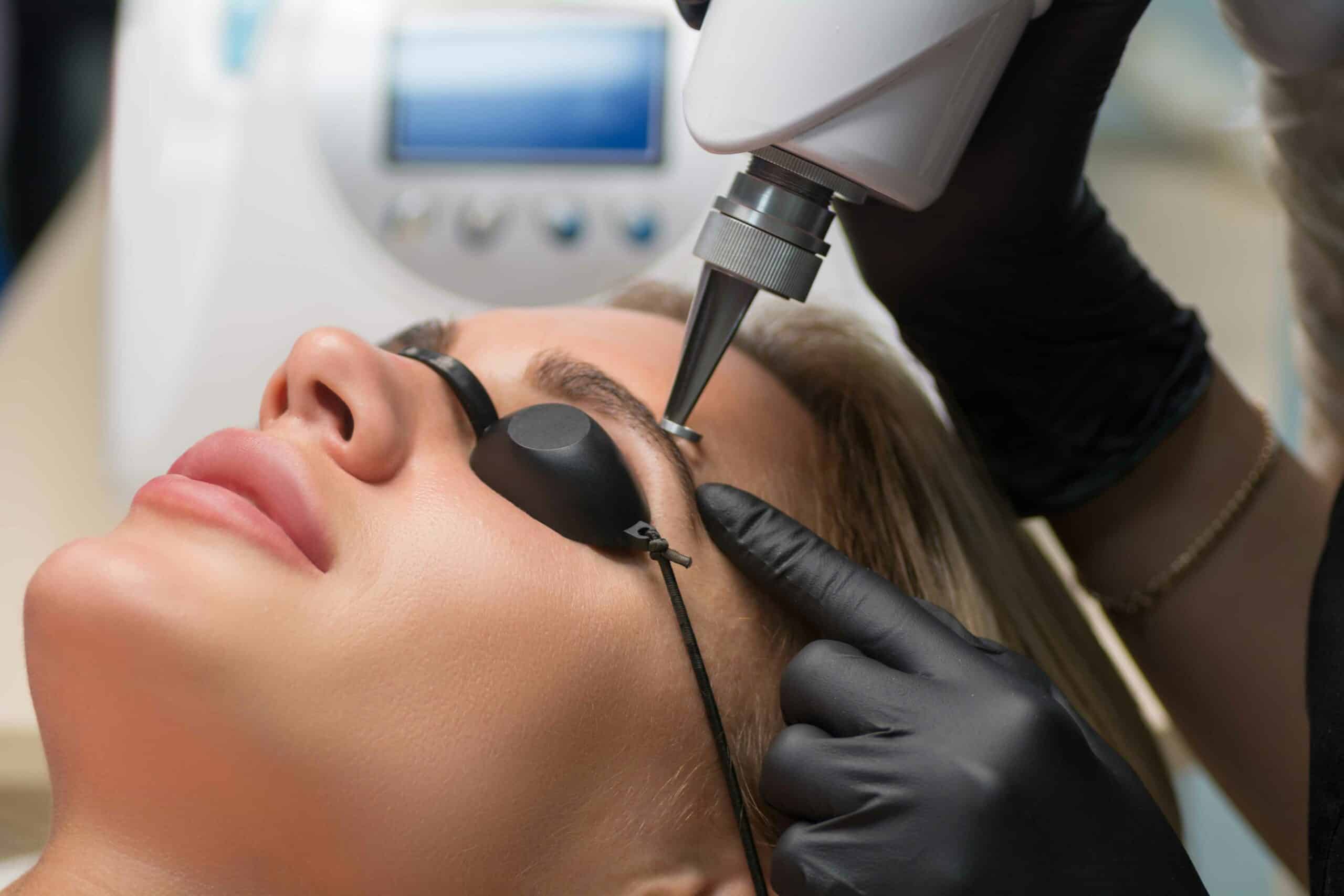 Eyebrow Tattoo Removal in Glendale, Encino, and Irvine, CA | New Look Skin Center Medical Spa in Glendale, Encino and Irvine, CA