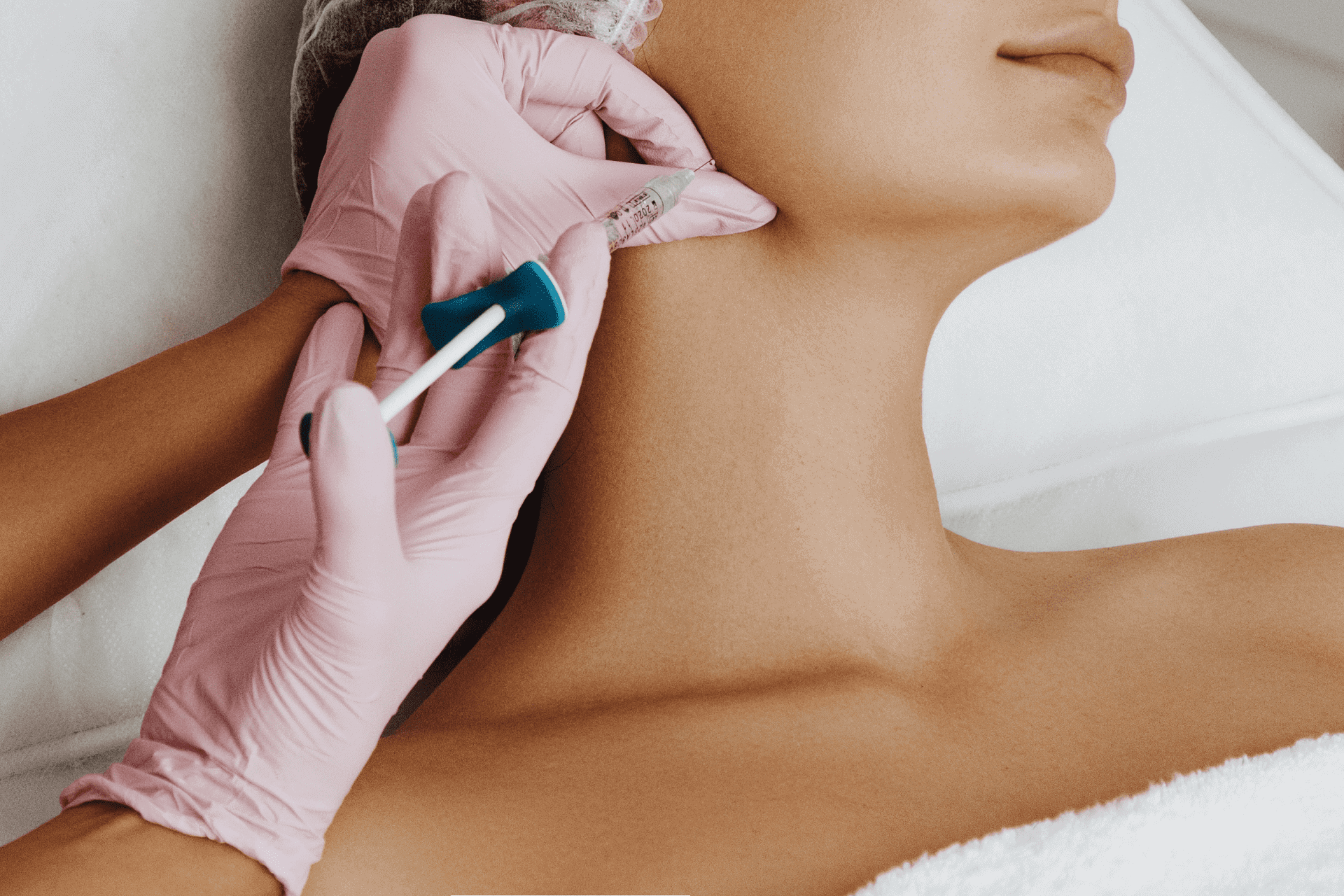 Juvederm in Glendale, Encino, and Irvine, CA | New Look Skin Center Medical Spa in Glendale, Encino and Irvine, CA