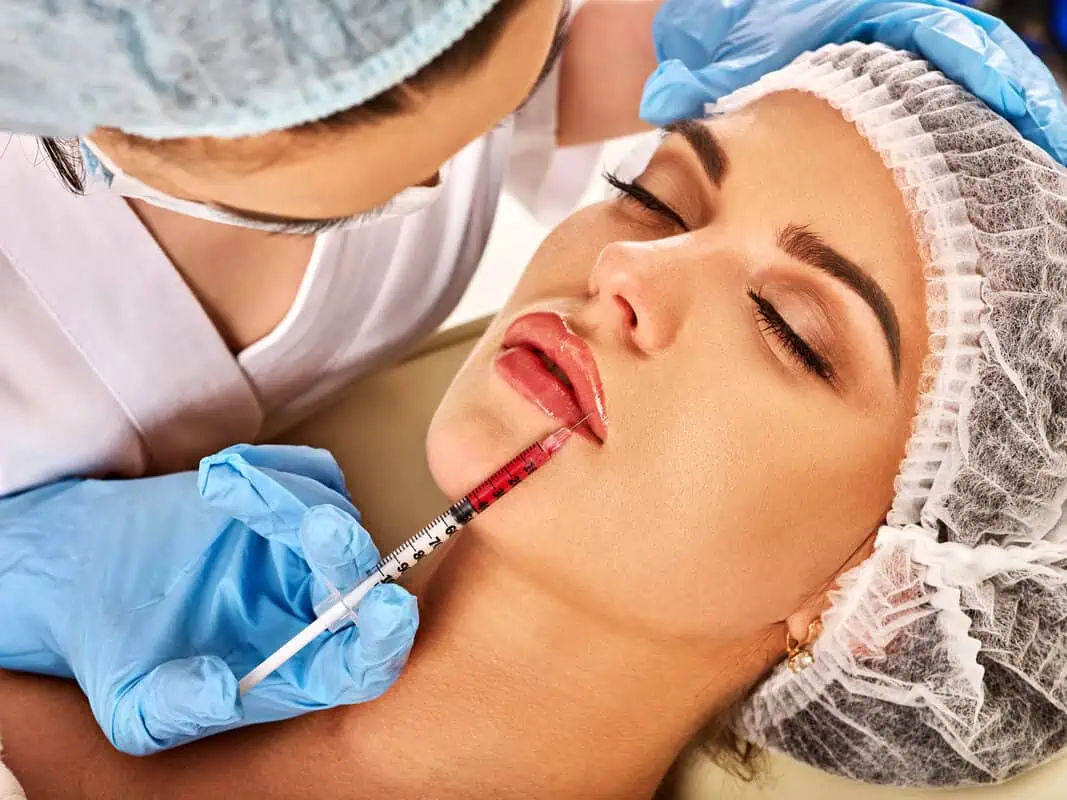 Restylane Fillers in New Look Skin Center