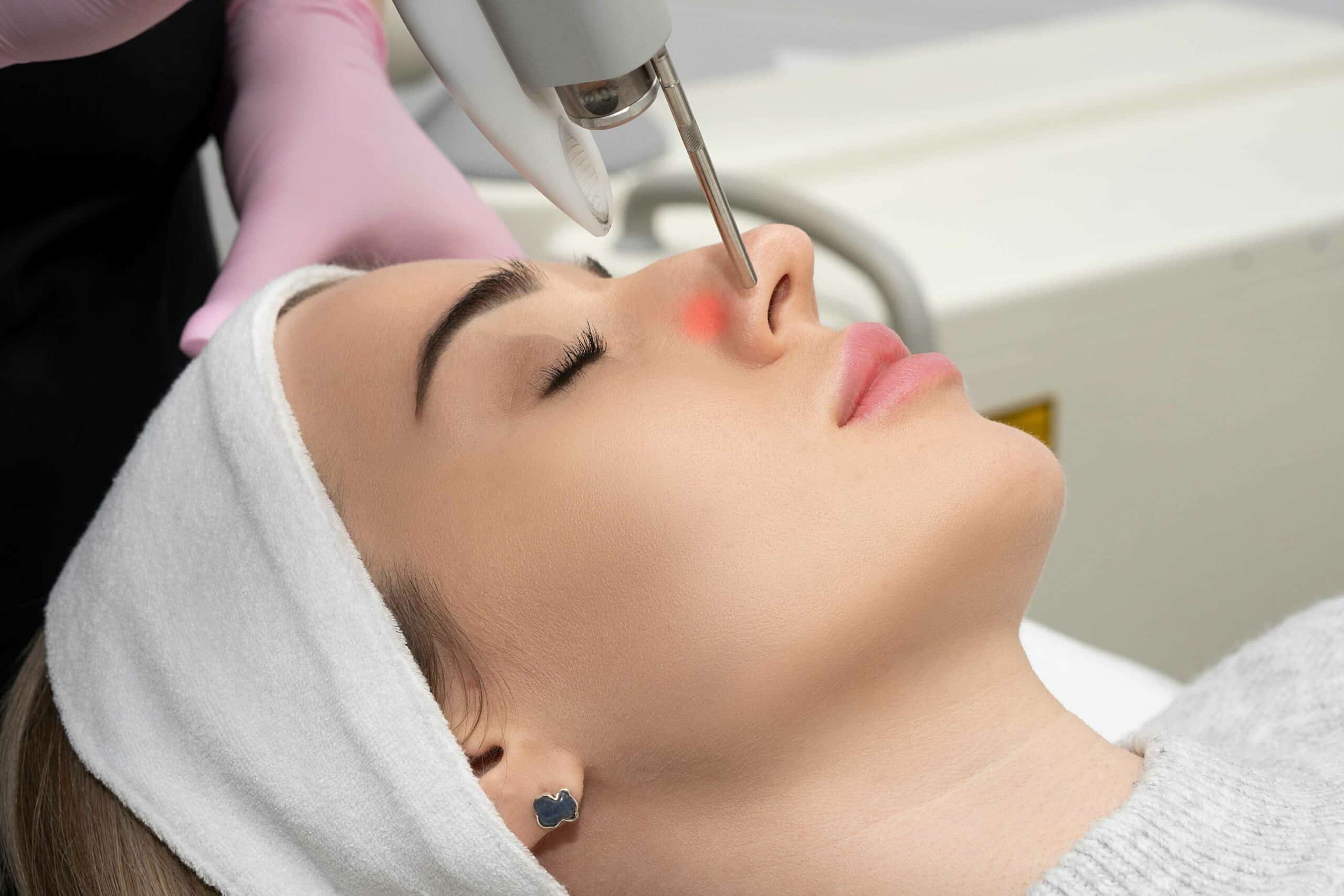 Laser Vein Treatment in Glendale, Encino, and Irvine, CA | New Look Skin Center Medical Spa in Glendale, Encino and Irvine, CA